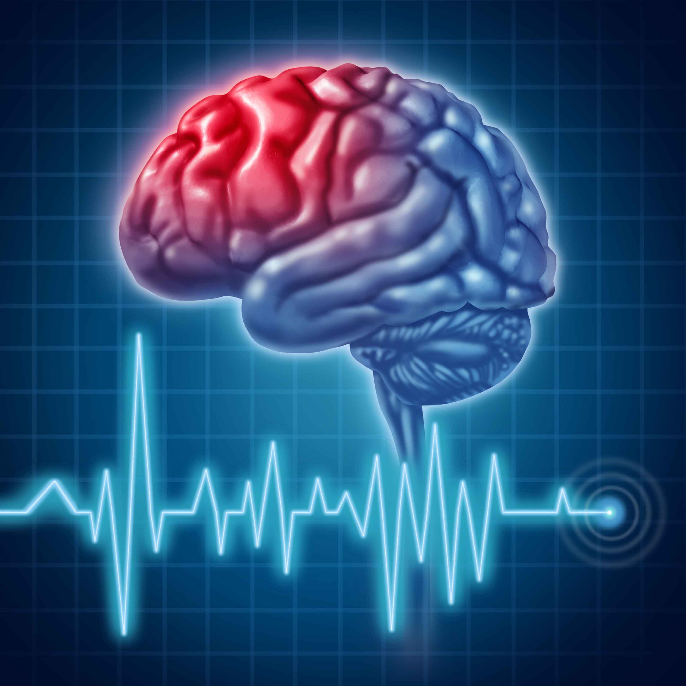 Bệnh tai biến mạch máu não và những vấn đề liên quan